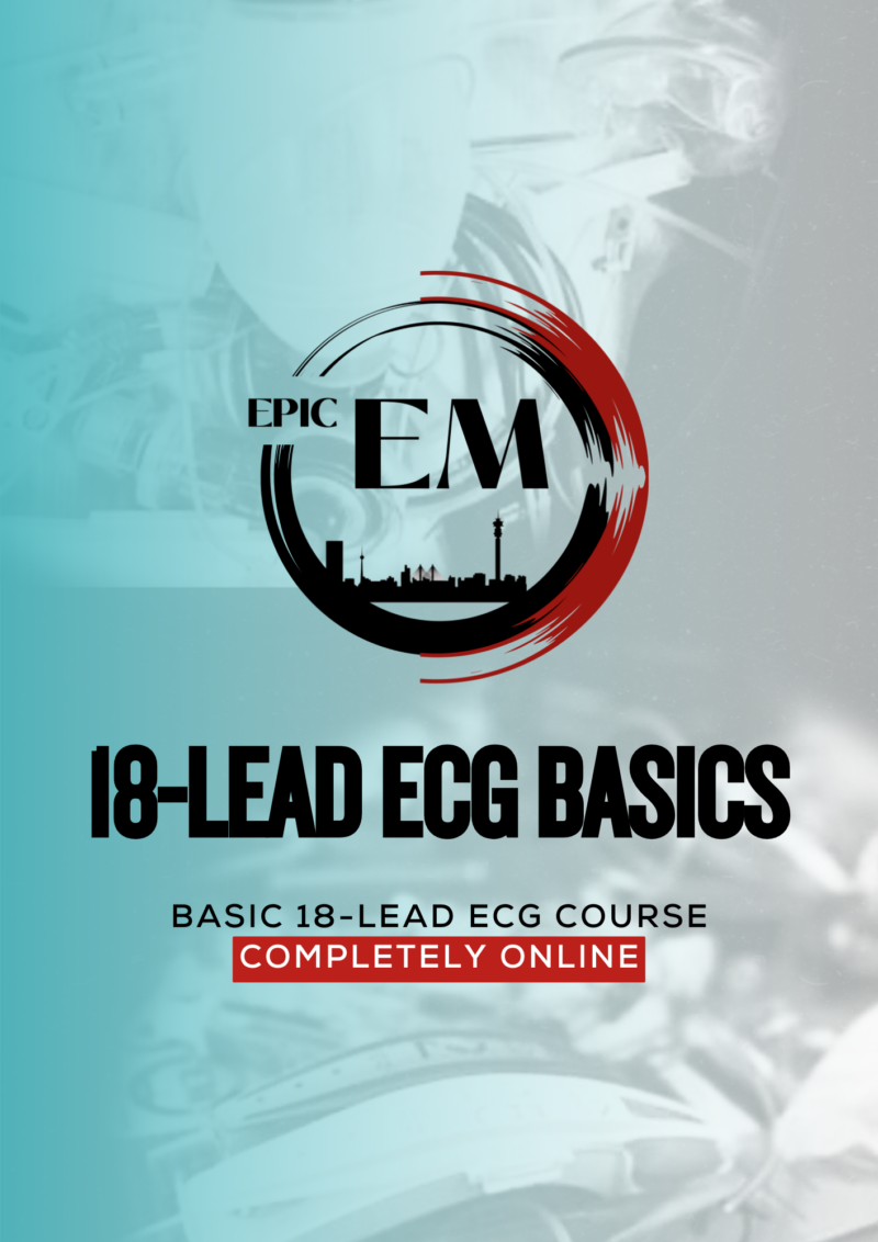 18 Lead ECG Basics ONLINE