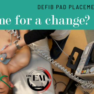 Defib pads and placement